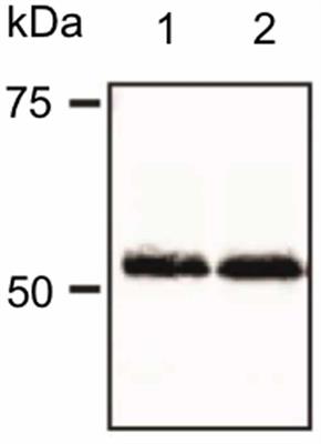 Gradient of Expression of Dopamine D2 Receptors Along the Dorso-Ventral Axis of the Hippocampus